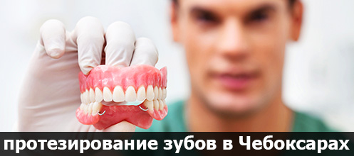 протезирование зубов в Чебоксарах