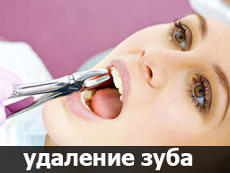 процесс удаления зубов в Чебоксарах
